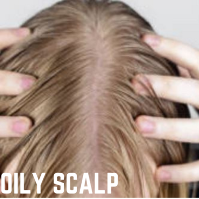 HC-OILY SCALP